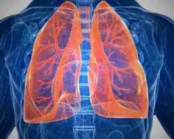 Cáncer de pulmón FOTO: WEB