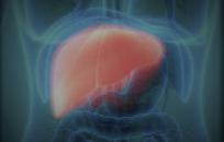 Cáncer de hígado FOTO: WEB Cáncer de hígado FOTO: WEB