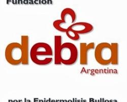 Fundación Debra Argentina FOTO: WEB