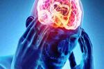 Epilepsia FOTO: WEB Epilepsia FOTO: WEB
