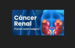 Cáncer renal FOTO: web