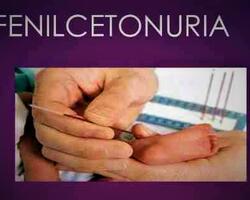 Fenilcetonuria FOTO: WEB