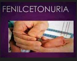 Fenilcetonuria  FOTO: web