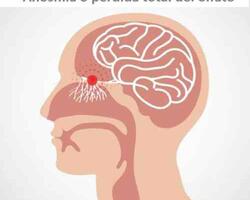 Anosmia FOTO: www.quironsalud.com