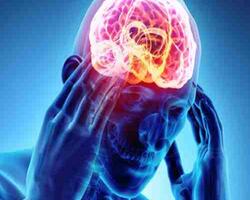 Epilepsia FOTO: WEB