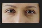 Ojos FOTO: WEB