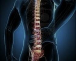Espondiloartritis Axial FOTO: WEB